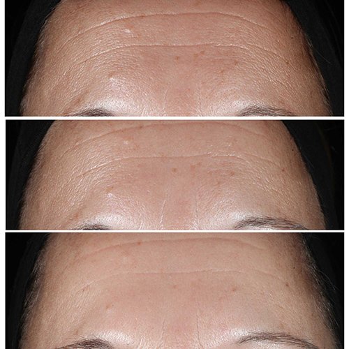 CLINIQUE-Smart Clinical Repair Serum - Anti-Wrinkle Correcting CLINIQUE-Smart Clinical Repair Serum - Anti-Wrinkle Correcting